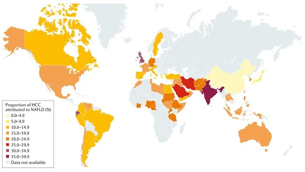 Nature 綜述：中國脂肪肝相關(guān)肝癌發(fā)病率將升高86%，急需預(yù)防！