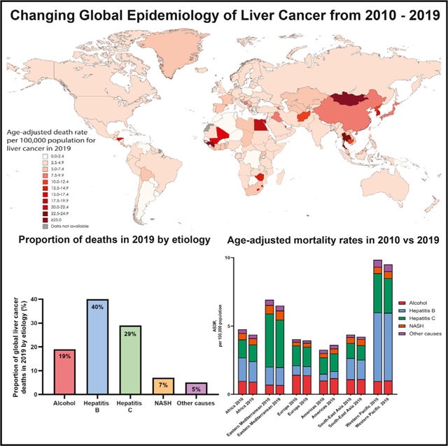2010-2019年全球肝癌流行病學(xué)變化：NASH為肝癌最快增長病因