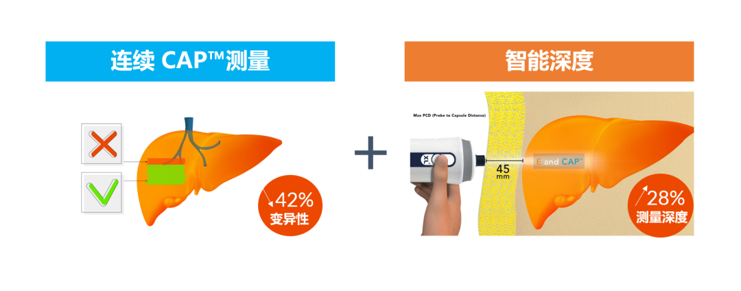 APASL2023 | SmartExam by FibroScan?在NAFLD中的應用優(yōu)勢