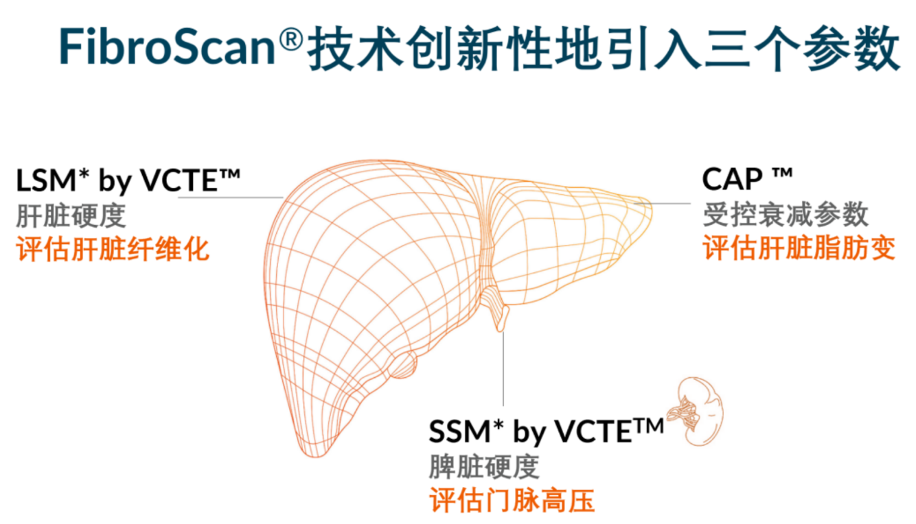喜訊！FDA擴大了FibroScan?在肝臟綜合管理中的應用范圍