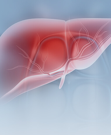 肝癌高風(fēng)險(xiǎn)人群解決方案