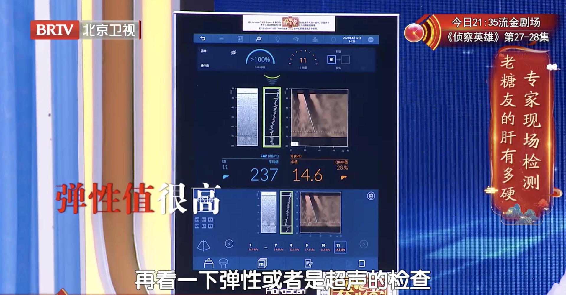 糖尿病肝損傷到底有多嚴(yán)重